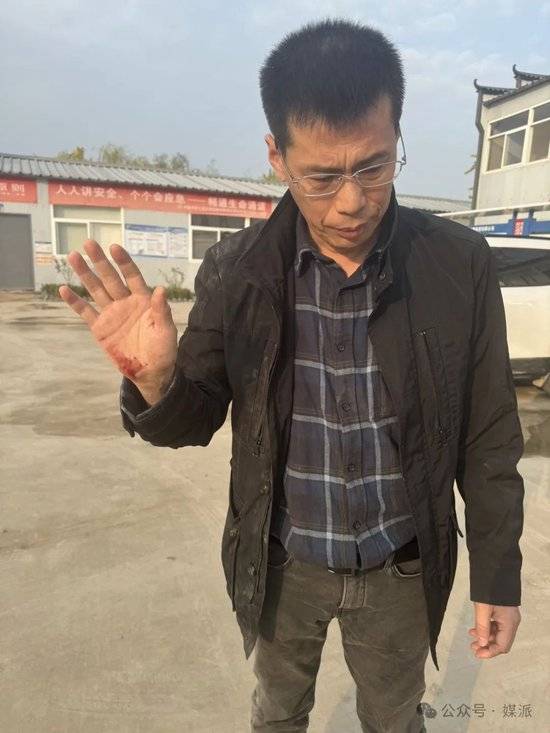 突发!新华社著名调查记者王文志、程子龙“合新铁路”追访被袭击受伤,手机被抢夺……