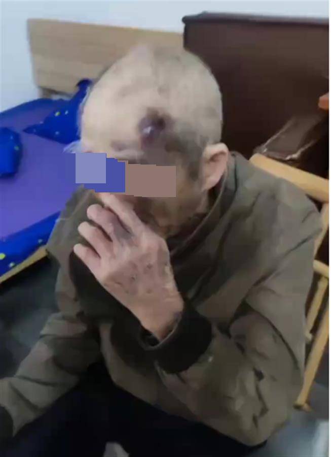 广东阳江一养老院护工长期虐待九旬老人?民政局已介入,警方:正了解情况