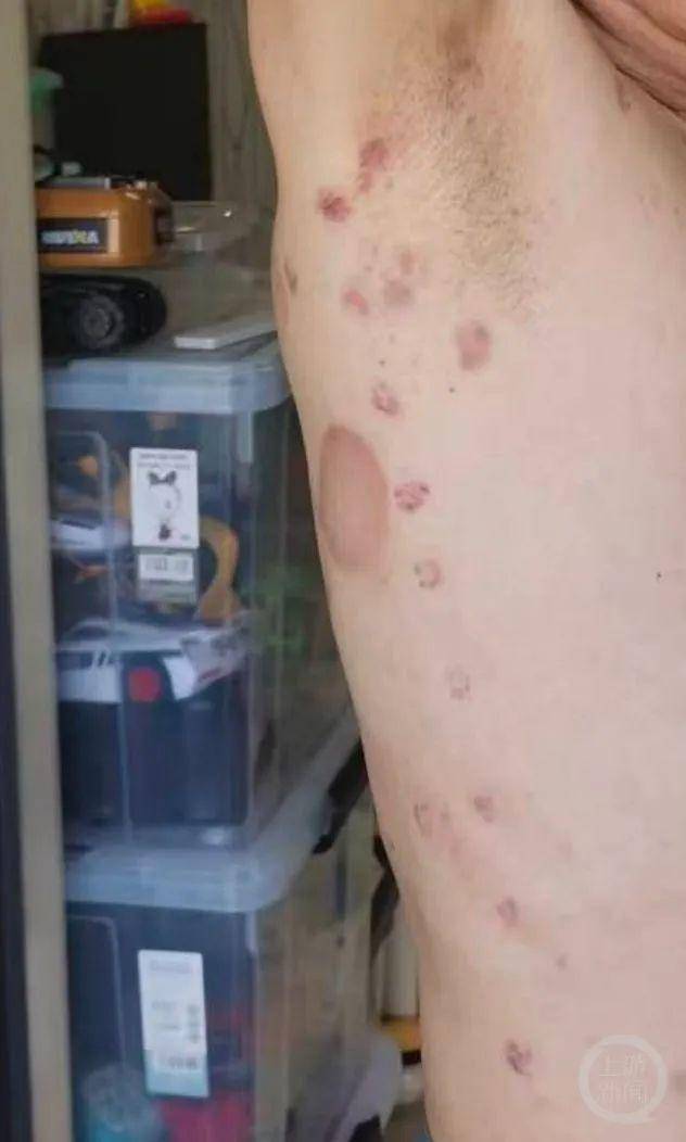 男子称理发店充430万做灌肠后遭退费难,合肥警方深夜通报